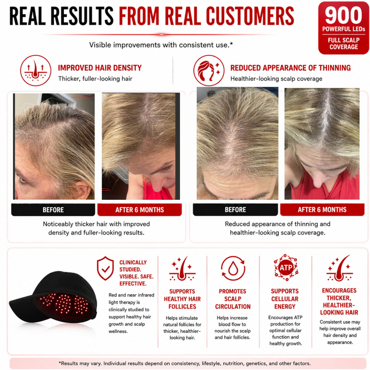 Red Light Pro Devices Red Light Therapy Hat | 900 Powerful LEDs | Full Scalp Coverage | 5 Wavelengths | Includes 12V Car Adapter
